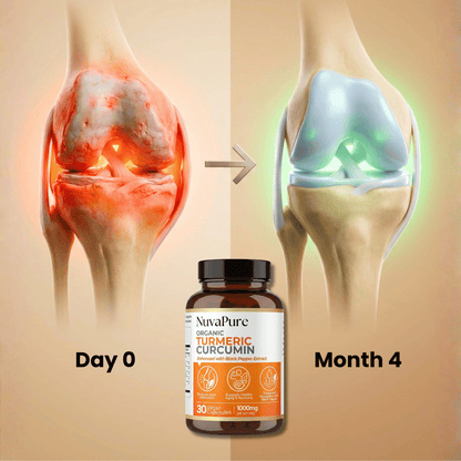 Turmeric Curcumin | Joint Relief Support